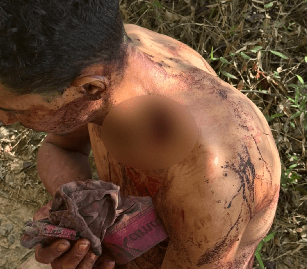 Nu e gravemente ferido, homem é resgatado pela Polícia Militar 