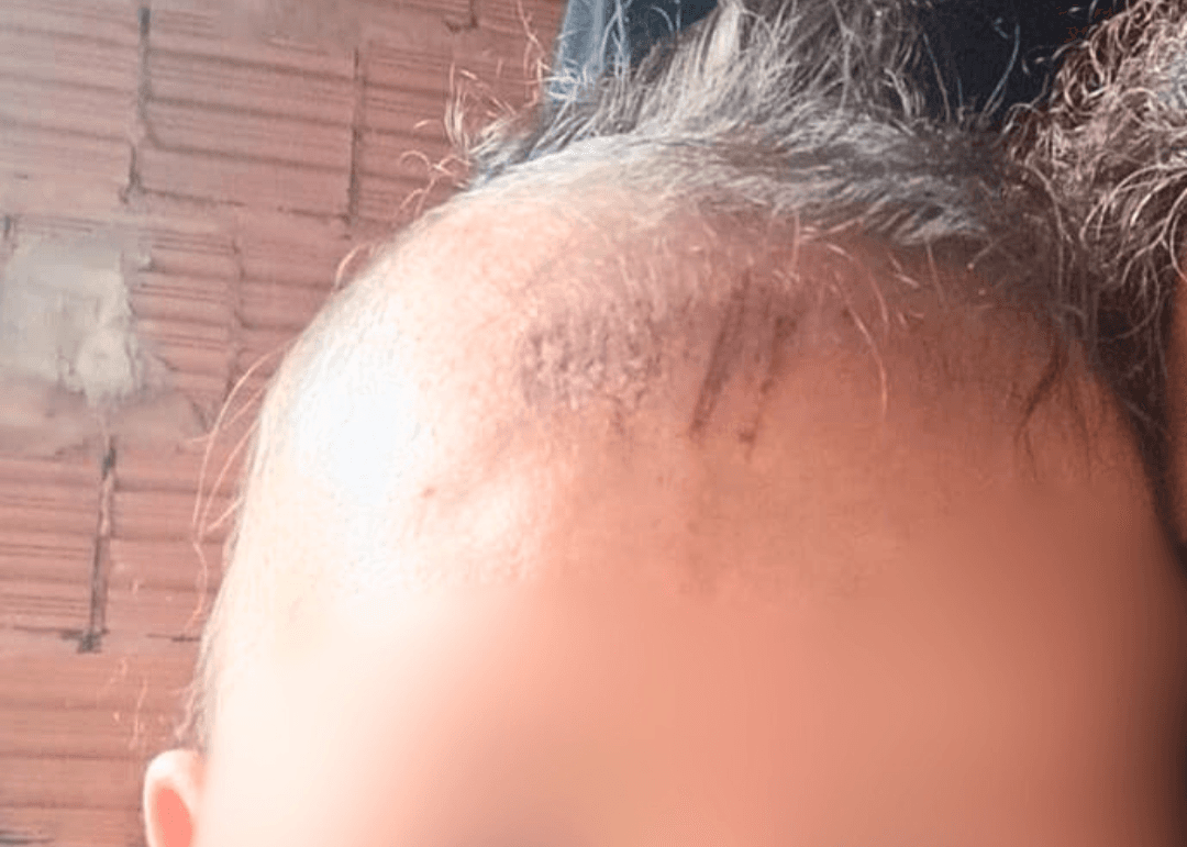 "A lama amorteceu a queda", diz avó de bebê atropelada por bêbado