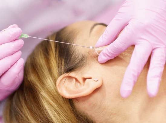Mulher ganha indenização após ter rosto deformado por fios de rejuvenescimento